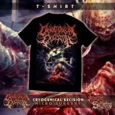 Cryogenical Excision - Micro Surgery - T-Shirt