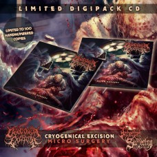 Cryogenical Excision - Micro Surgery - Limited Digipack CD
